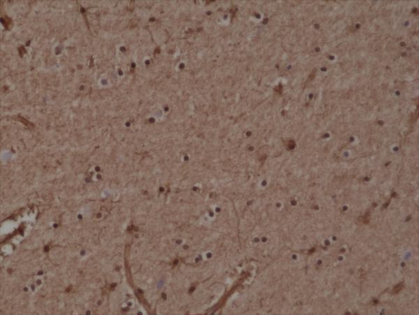  IHC resultImmunohistochemical staining of formalin fixed and paraffin embedded human Brain tissue section using anti-GSTP1 rabbit monoclonal antibody (Clone RM347) at a 1:20000 dilution
