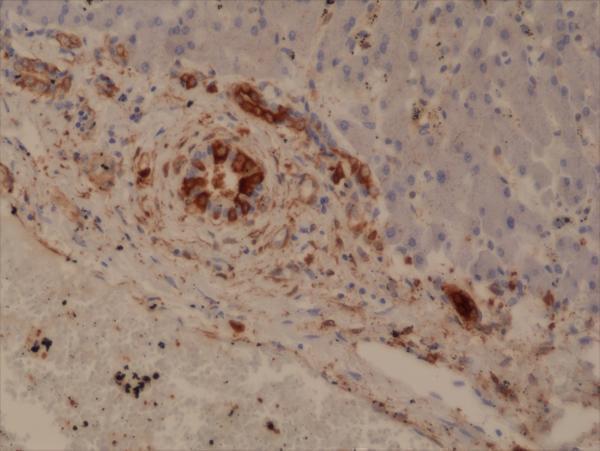  IHC resultImmunohistochemical staining of formalin fixed and paraffin embedded human Liver tissue section using anti-GSTP1 rabbit monoclonal antibody (Clone RM347) at a 1:20000 dilution