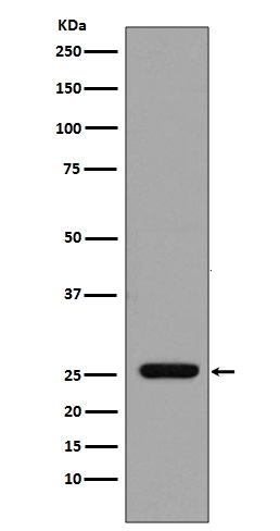 Western blot analysis of GST expression in GST recombinant protein