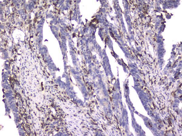 M00458 1 ITGB2 primary antibodies IHC testing 1_1