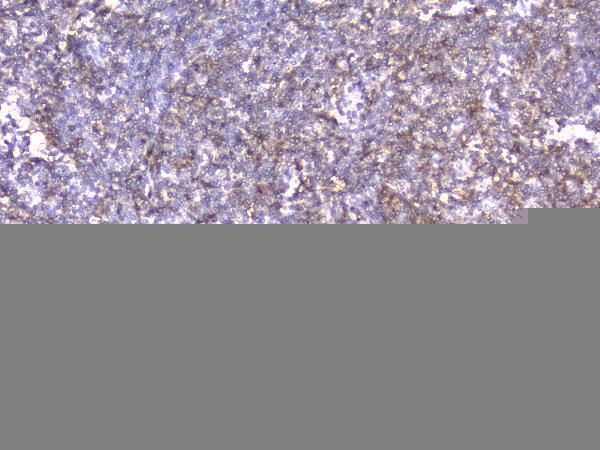 M00458 1 ITGB2 primary antibodies IHC testing 2_1