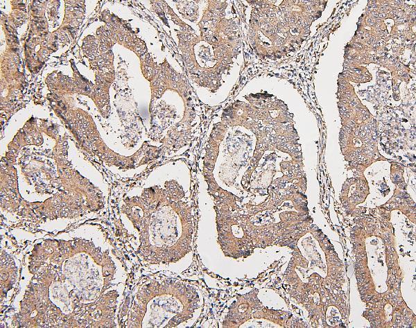 M00464 COMT primary antibodies IHC testing 2