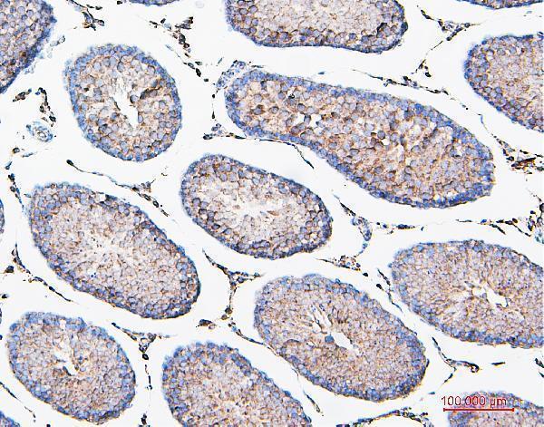 M00464 COMT primary antibodies IHC testing 8