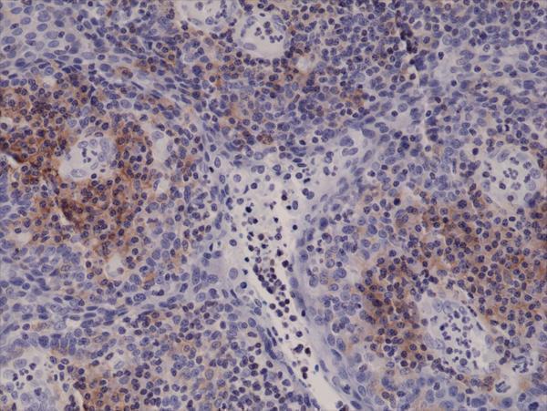  IHC resultImmunohistochemical staining of formalin fixed and paraffin embedded human Tonsil tissue sections using Anti-Integrin alpha 4 Rabbit Monoclonal Antibody (Clone RM268) at a 1:5000 dilution