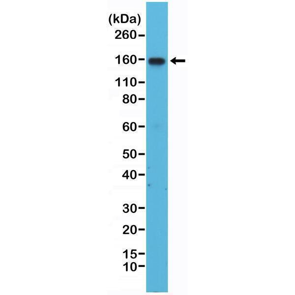  Western Blotting resultWestern Blot of Jurkat cells lysates using Anti-Integrin alpha 4 Rabbit Monoclonal Antibody (Clone RM268) at a 1:1000 dilution