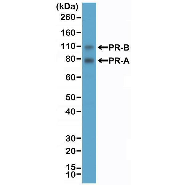  Western Blotting resultWestern Blot of T47D cell lysate using anti-Progesterone Receptor (PR) rabbit monoclonal antibody (clone RM357) at a 1:2000 dilution