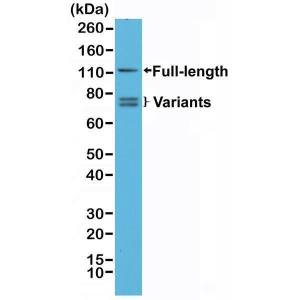  Western Blotting resultWestern Blot analysis of 22RV1 whole cell lysates, using anti-Androgen Receptor (N-term) rabbit monoclonal antibody (Clone RM254), showed full length androgen receptor and splice variants expressed in 22RV1 cells