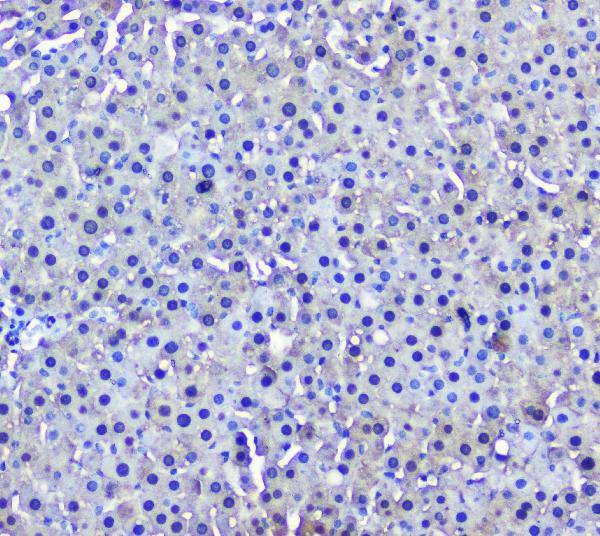 IHC analysis of GSTM1 using anti-GSTM1 antibody (M00569). GSTM1 was detected in paraffin-embedded section of rat liver tissue. Heat mediated antigen retrieval was performed in citrate buffer (pH6, epitope retrieval solution) for 20 mins. The tissue section was blocked with 10% goat serum. The tissue section was then incubated with 2μg/ml mouse anti-GSTM1 Antibody (M00569) overnight at 4°C. Biotinylated goat anti-mouse IgG was used as secondary antibody and incubated for 30 minutes at 37°C. The tissue section was developed using Strepavidin-Biotin-Complex (SABC)(Catalog # SA1021) with DAB as the chromogen.
