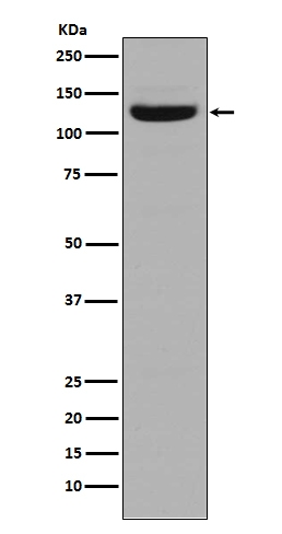 Western blot analysis of Collagen I in Human stomach tissue lysate
