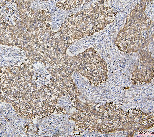  IHC analysis of HSP27 using anti-HSP27 antibody (M00676-5)