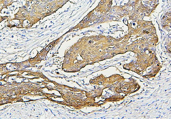  IHC analysis of HSP27 using anti-HSP27 antibody (M00676-5)