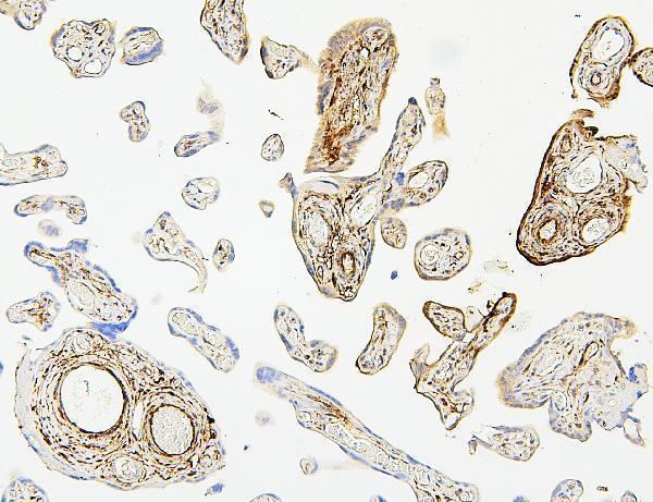 M00676 5 HSP27 primary antibodies IHC testing 4