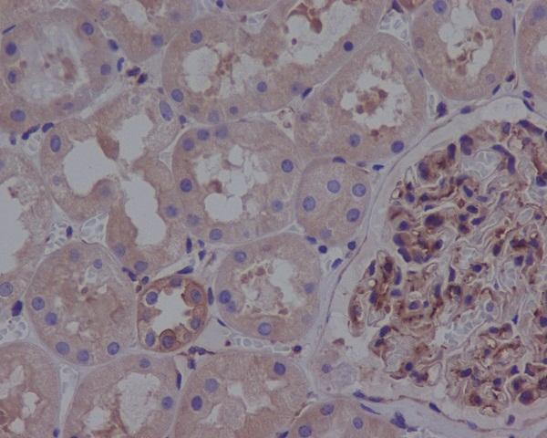 Immunohistochemical analysis of paraffin-embedded human kidney, using ROCK1 Antibody(M00722)ROCK1 was detected in paraffin-embedded tissue section