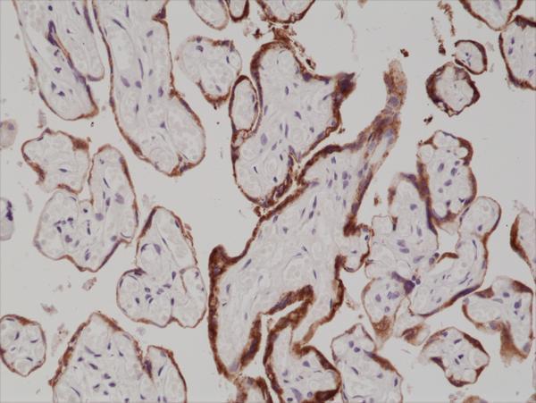 IHC resultImmunohistochemical staining of formalin fixed and paraffin embedded human placenta tissue section using anti-hCG rabbit monoclonal antibody (Clone RM330) at a 1:1000 dilution