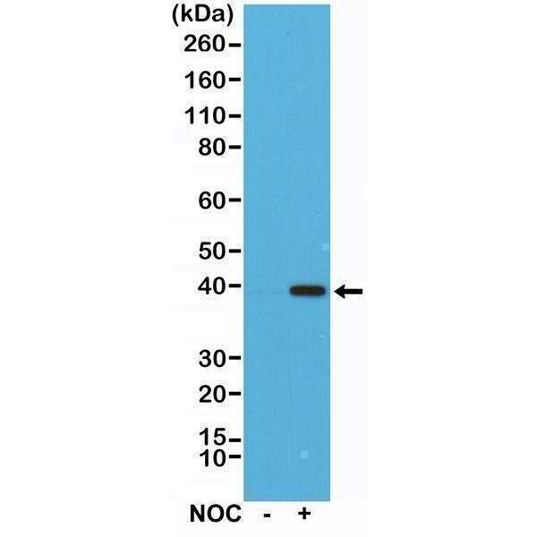  Western Blotting resultWestern Blot of HeLa cells nontreated (-) or treated (+) with Nocodazole (NOC), using Anti-Aurora B Rabbit Monoclonal Antibody (Clone RM278) at a 1:1000 dilution