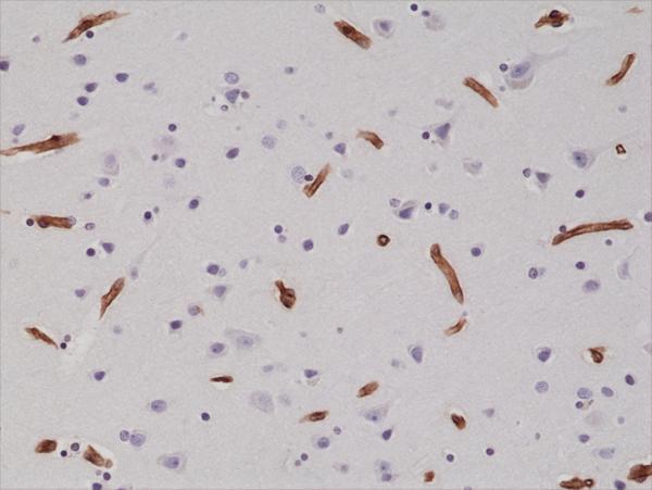  IHC resultImmunohistochemical staining of formalin fixed and paraffin embedded human brain tissue sections using anti-CD29 rabbit monoclonal antibody (clone RM285) at a 1:200 dilution