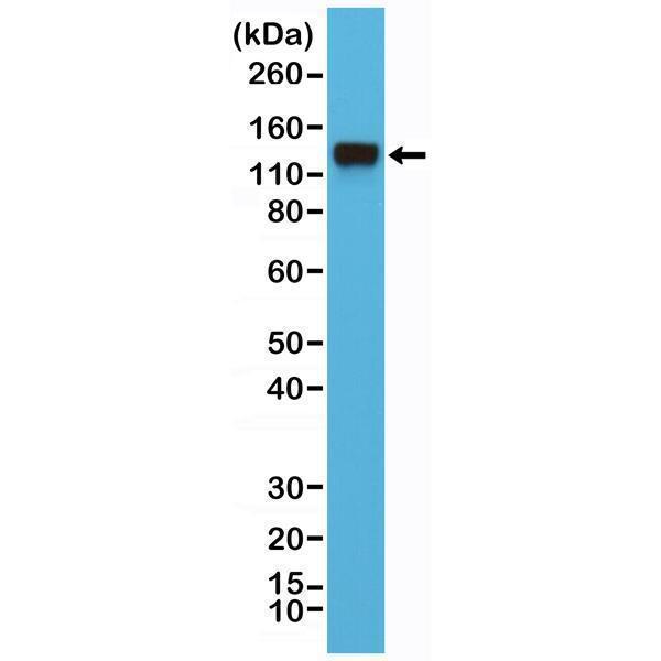  Western Blotting resultWestern Blot of HeLa cell lysates using anti-CD29 rabbit monoclonal antibody (clone RM285) at a 1:4000 dilution