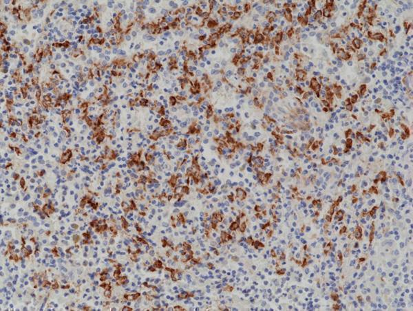  IHC resultImmunohistochemical staining of formalin fixed and paraffin embedded human spleen tissue section using anti-CD163 rabbit monoclonal antibody (Clone RM371) at a 1:1000 dilution
