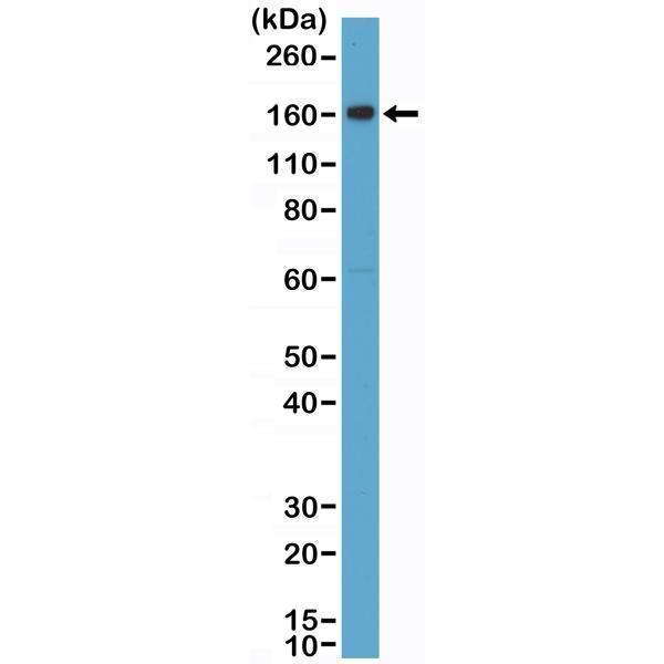  Western Blotting resultWestern Blot of human placenta tissue lysate using anti-CD163 rabbit monoclonal antibody (Clone RM371) at a 1:2000 dilution