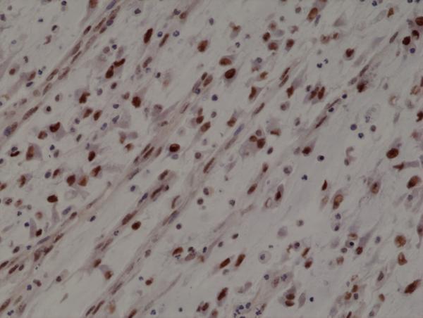 M00964 2 IHC test result image 2