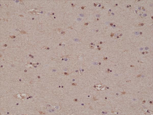  IHC resultImmunohistochemical staining of formalin fixed and paraffin embedded human brain tissue section using anti-S100B rabbit monoclonal antibody (Clone RM304) at a 1:1000 dilution