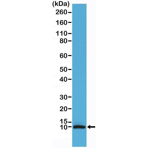  Western Blotting resultWestern Blot of human brain tissue lysate using anti-S100B rabbit monoclonal antibody (Clone RM304) at a 1:100 dilution