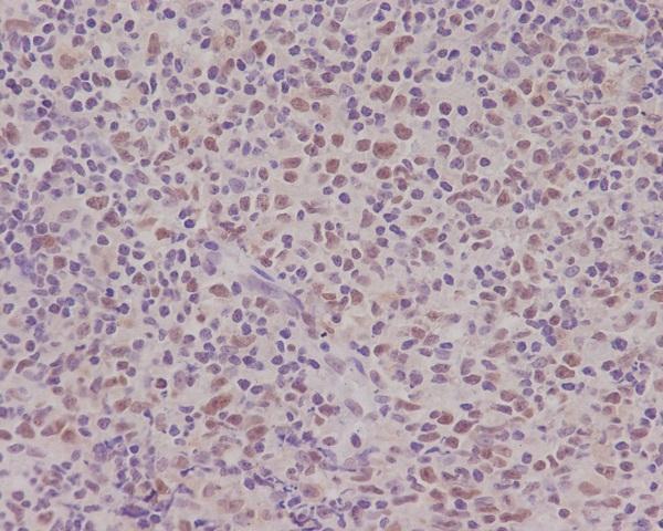 Immunohistochemical analysis of paraffin-embedded human tonsil, using PMS2 Antibody