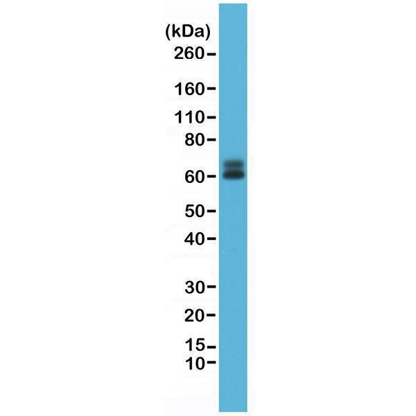 M01033 1 WB test result image 1