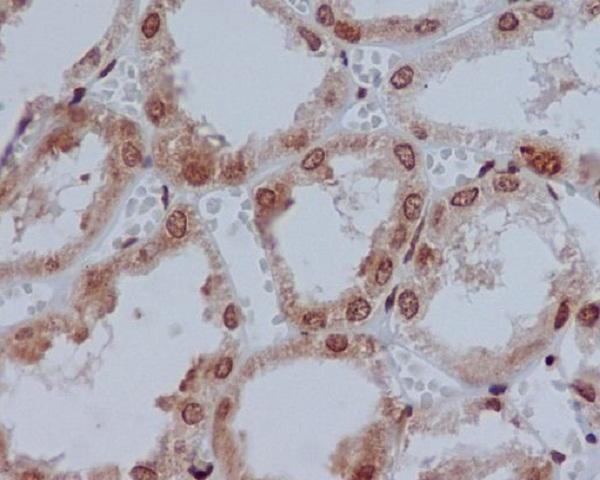 M01054 YBX1 primary antibodies IHC testing 1