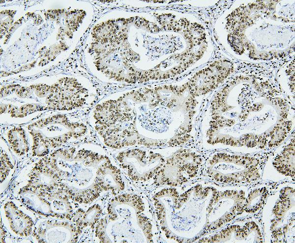 M01129 1 NRF1 primary antibodies IHC testing 2