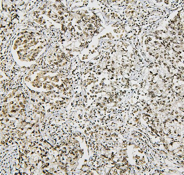 M01129 1 NRF1 primary antibodies IHC testing 3