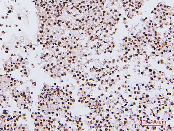 M01129 1 NRF1 primary antibodies IHC testing 5