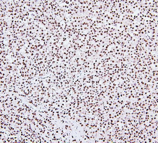 M01129 1 NRF1 primary antibodies IHC testing 6
