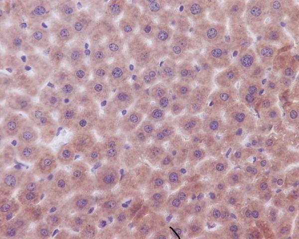 M01163 BAK1 primary antibodies IHC testing 1