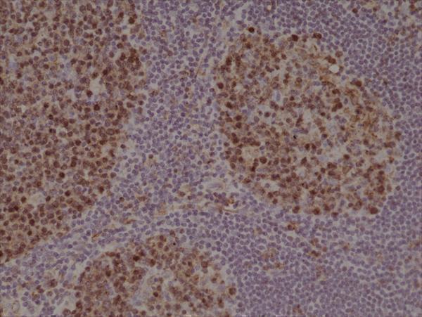  IHC resultImmunohistochemical staining of formalin fixed and paraffin embedded human tonsil tissue section using anti-Stathmin rabbit monoclonal antibody (Clone RM350) at a 1:1000 dilution