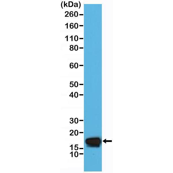 Western Blotting resultWestern Blot of HeLa cell lysate using anti-Stathmin rabbit monoclonal antibody (Clone RM350) at a 1:5000 dilution