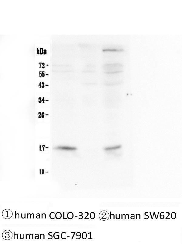  Western blot analysis of FHIT using anti-FHIT antibody (M01200)