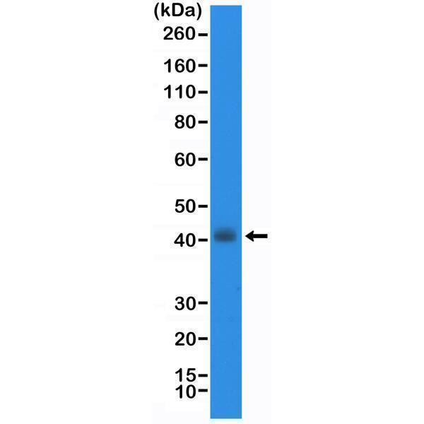  Western Blotting resultWestern Blot of TT cell lysate using anti-TTF1 rabbit monoclonal antibody (Clone RM373) at a 1:20000 dilution