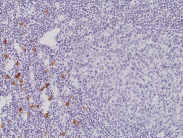 M01335 2 IHC test result image 3