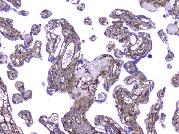 IHC analysis of Collagen IV using anti-Collagen IV antibody (M01411). Collagen IV was detected in paraffin-embedded section of human placenta tissue. Heat mediated antigen retrieval was performed in citrate buffer (pH6, epitope retrieval solution) for 20 mins. The tissue section was blocked with 10% goat serum. The tissue section was then incubated with 2μg/ml mouse anti-Collagen IV Antibody (M01411) overnight at 4°C. Biotinylated goat anti-mouse IgG was used as secondary antibody and incubated for 30 minutes at 37°C. The tissue section was developed using Strepavidin-Biotin-Complex (SABC)(Catalog # SA1021) with DAB as the chromogen.