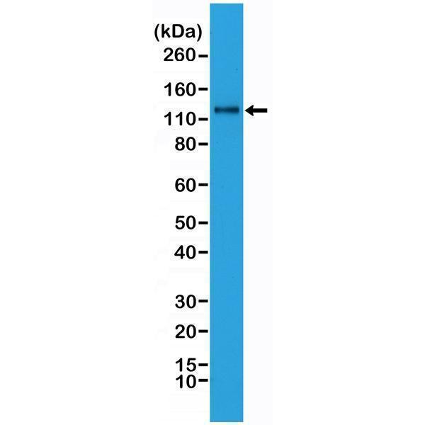  Western Blotting resultWestern Blot analysis of HeLa whole cell lysates, using anti-N-cadherin rabbit monoclonal antibody (Clone RM259), showed N-cadherin expression in HeLa cells