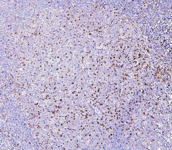 M01608 RAB27A primary antibodies IHC testing 2
