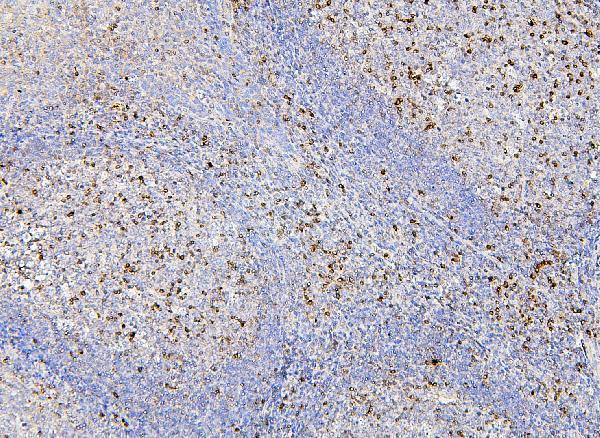 M01608 RAB27A primary antibodies IHC testing 3