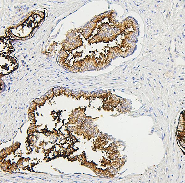 M01608 RAB27A primary antibodies IHC testing 4