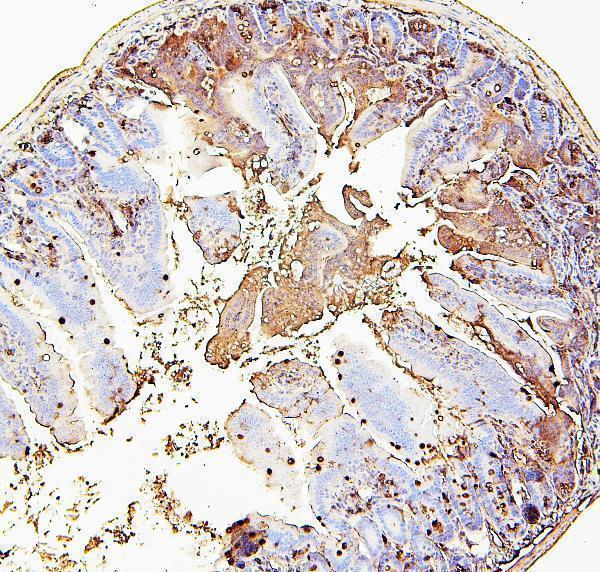M01608 RAB27A primary antibodies IHC testing 5