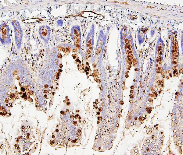 M01608 RAB27A primary antibodies IHC testing 6