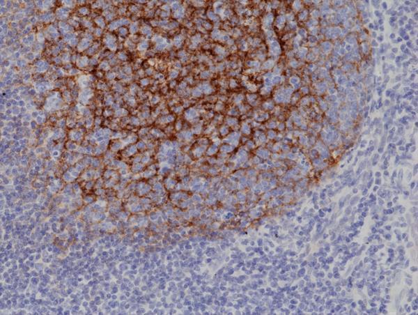  IHC resultImmunohistochemical staining of formalin fixed and paraffin embedded human tonsil tissue section using anti-CD21 rabbit monoclonal antibody (Clone RM372) at a 1:1000 dilution