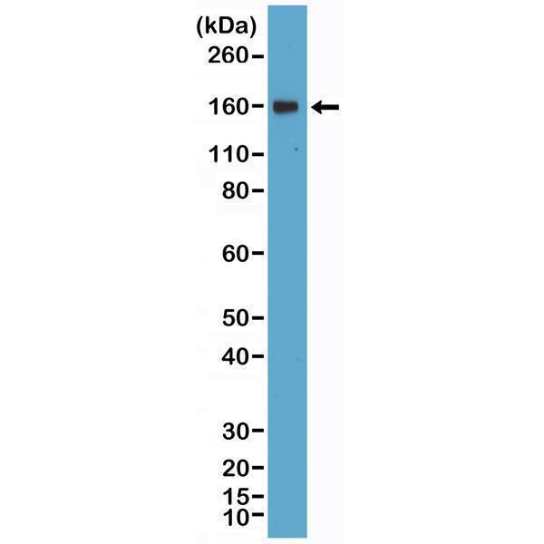  Western Blotting resultWestern Blot of Daudi lysate using anti-CD21 rabbit monoclonal antibody (Clone RM372) at a 1:400 dilution
