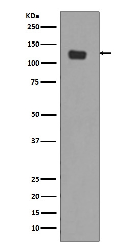 Western blot analysis of Integrin alpha 6 expression in SW480 cell lysate (M01693)