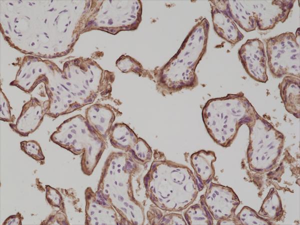 M01718 1 IHC test result image 2